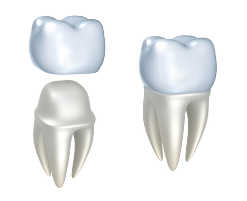 Dentists Develop Restorative Crowns for Children