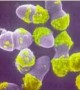 Anti-biofilm molecule may help fight superbugs Anti-biofilm molecule may help fight superbugs
