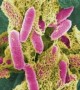 New Method May Pinpoint Certain Bacteria New Method May Pinpoint Certain Bacteria