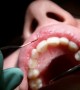 Only 1 Percent of Canadian Children See A Dentist within Their First Year of Life Only 1 Percent of Canadian Children See A Dentist within Their First Year of Life